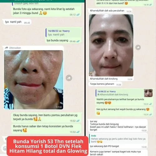 Testimoni Bunda Yorish